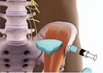 微信圖片_20221118094516.jpg 微信圖片_20221118094516.jpg