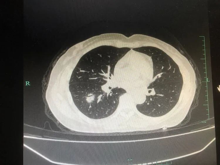 微信圖片_20220117100331.jpg 微信圖片_20220117100331.jpg