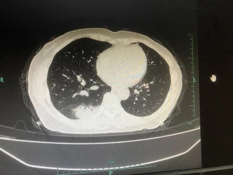 微信圖片_20220117100334.jpg 微信圖片_20220117100334.jpg